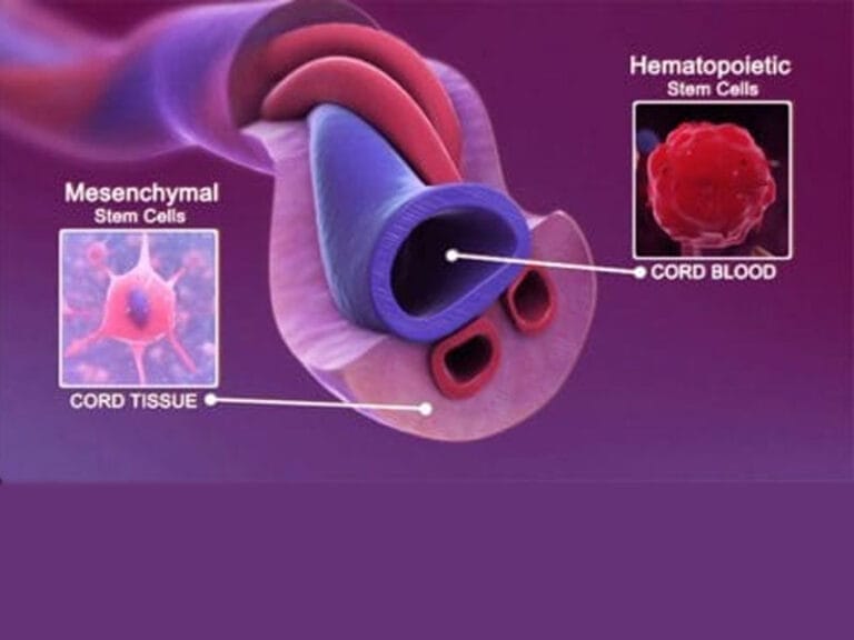 Diagram showing mesenchymal stem cells from cord tissue and hematopoietic stem cells from cord blood, with arrows pointing to respective sources.